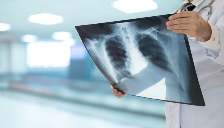 Comissão da Câmara discute incorporação da terapia tripla no tratamento da fibrose cística