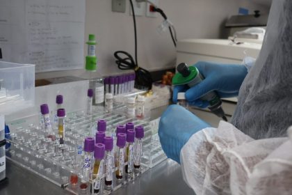 Doação de sangue é essencial para manter atendimentos no Complexo Hospitalar Sul e Instituto Dona Lindu