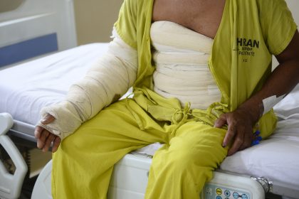 Queimaduras em acidente de trabalho deixam pedreiro internado no Hran e mobilizam unidade especializada