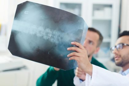Anvisa autoriza testes com polilaminina e Câmara fará audiência sobre regeneração da medula espinhal