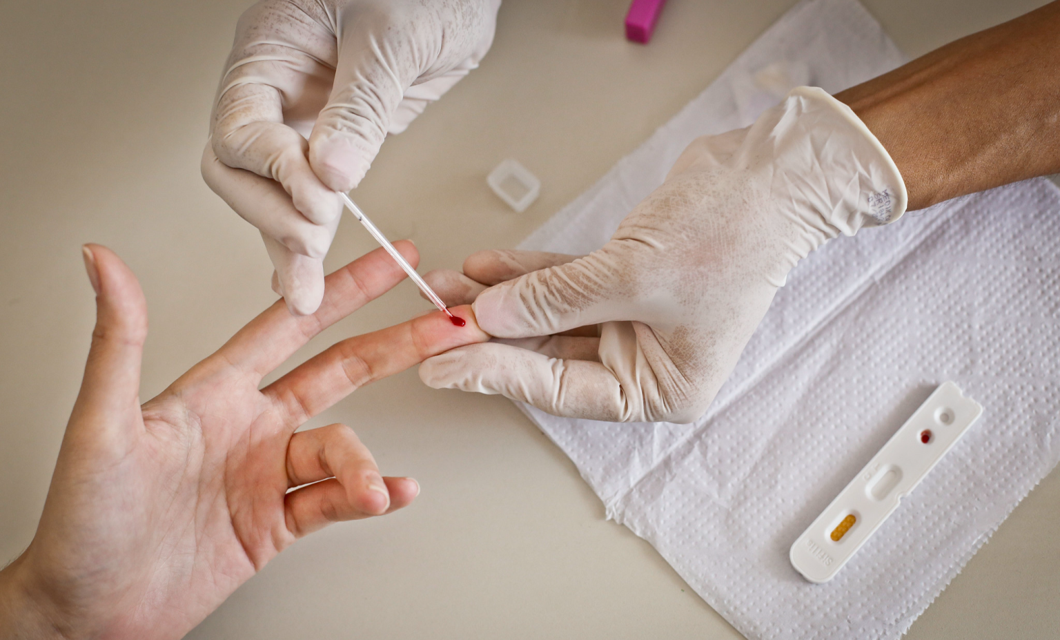 Mais da metade das pessoas com HIV no Brasil relata discriminação que atrasa diagnóstico e tratamento