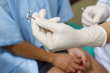 Implanon chega à rede pública do Distrito Federal e amplia opções contraceptivas na Atenção Primária