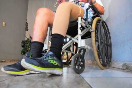 Programa de Órteses e Próteses (OPM) oferece equipamentos gratuitos a pacientes da rede pública
