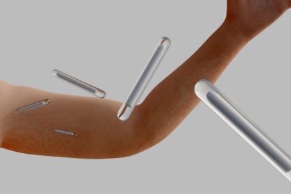 Projeto de Lei 3065/26 propõe proibir prescrição de implantes hormonais para fins estéticos e de desempenho físico