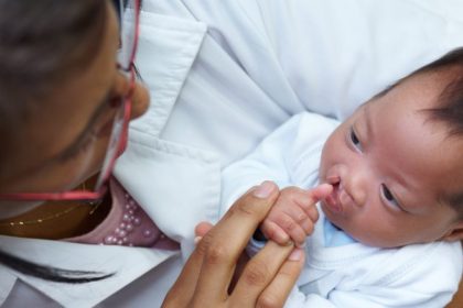 Comissão de Saúde aprova inclusão de responsáveis no acompanhamento psicológico do SUS para pacientes com fissura labiopalatina