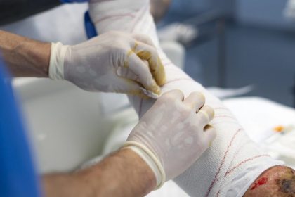 Projeto de Lei 3164/26 busca garantir acesso integral a tratamentos para queimaduras no SUS e na saúde suplementar
